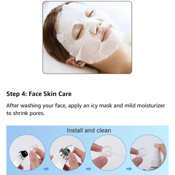 Facial Blackhead Remover Pore Vacuum -Pore Cleaner 5 Suction, Rechargeable - Picture 13 of 15